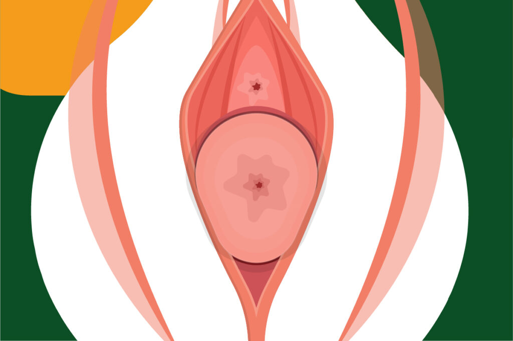 prolapsus génital