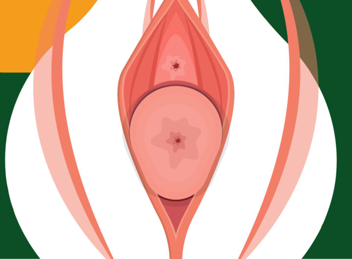 prolapsus génital